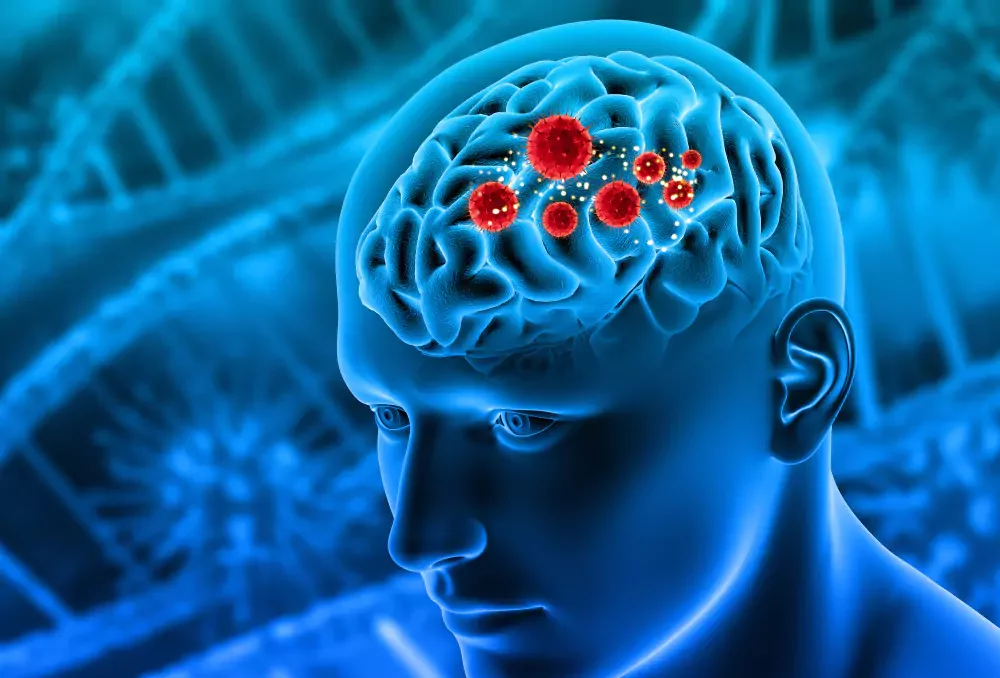 Neurodegenerative Disorders